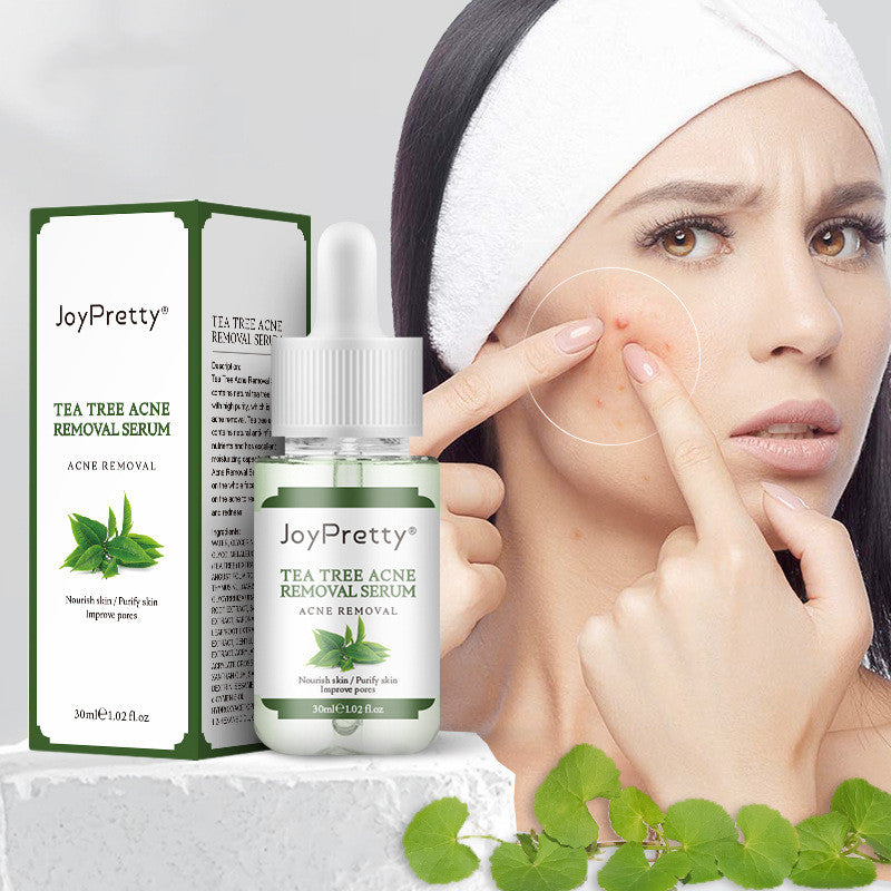 Joy Pretty, tree serum for acne treatment